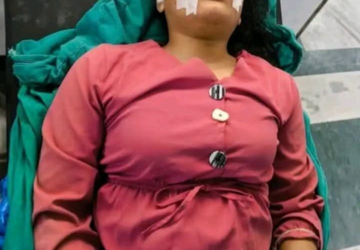 शिक्षक आन्दोलनमा झडप हुँदा पत्रकार सबिना कार्की घाइते