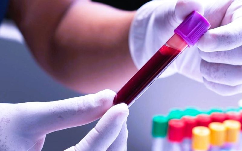 रगत परीक्षणबाट ५० भन्दा बढी प्रकारका क्यान्सर पहिचान सम्भव, प्रारम्भिक चरणमै उपचारको सम्भावना बलियो