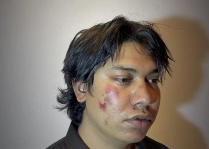 कन्टेन्ट क्रियटर Arzun ARK माथि आक्रमणप्रति चर्को विरोध, अभिव्यक्ति स्वतन्त्रता संरक्षणको माग