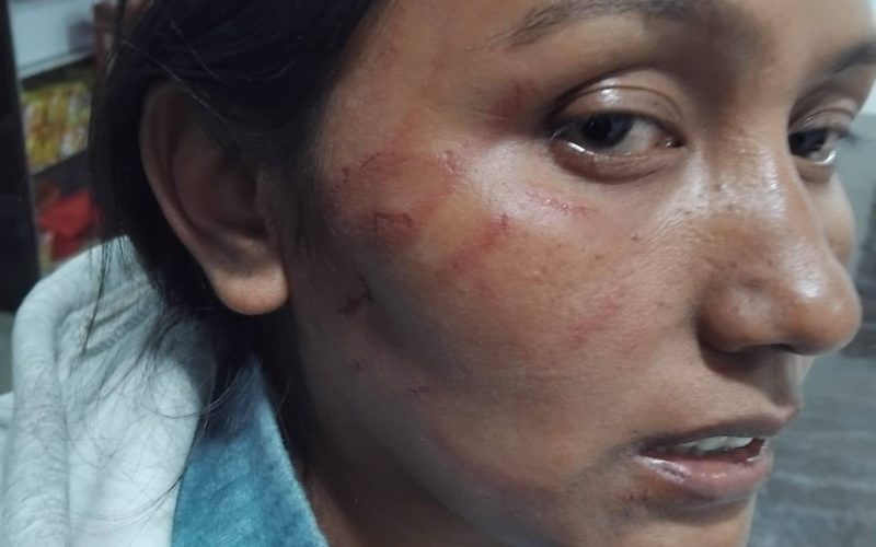 सिन्धुलीमा खाजा घर सञ्चालक महिलामाथि कुटपिट, ट्रक चालक समूह फरार