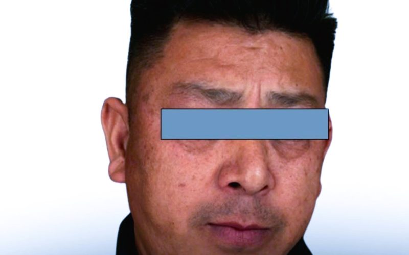 नगरकोटमा भ्लगरमाथि कुटपिट गर्ने व्यक्ति पक्राउ